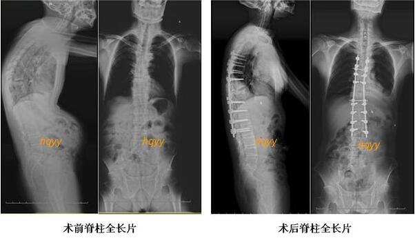 QQ截图20170402150251.jpg